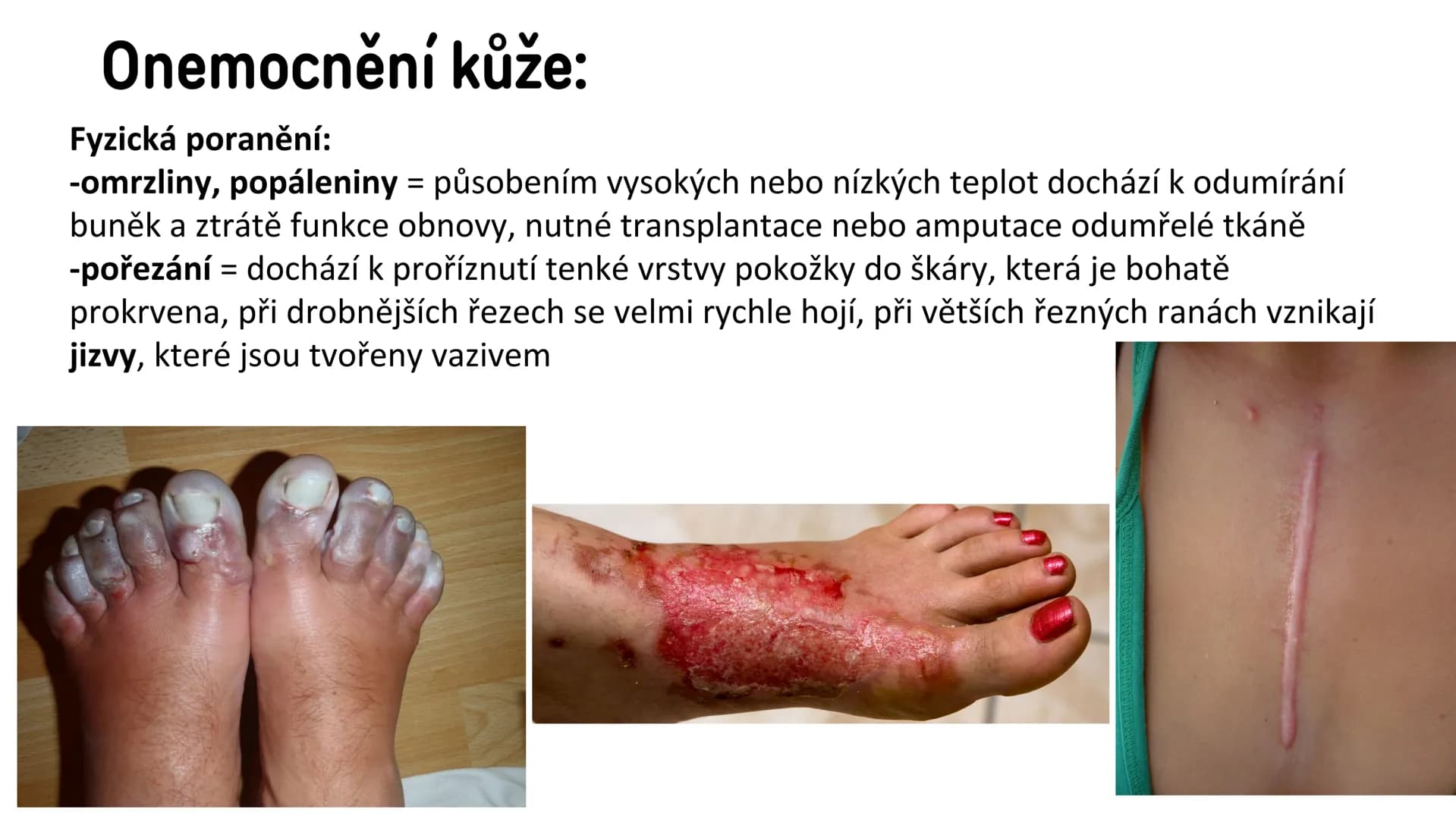 # Vylučovací soustava

- ledvina
- močovod
- močový měchýř
- močová trubice

řez ledvinou # Vylučovací soustava:

• funkce: - odstraňování o