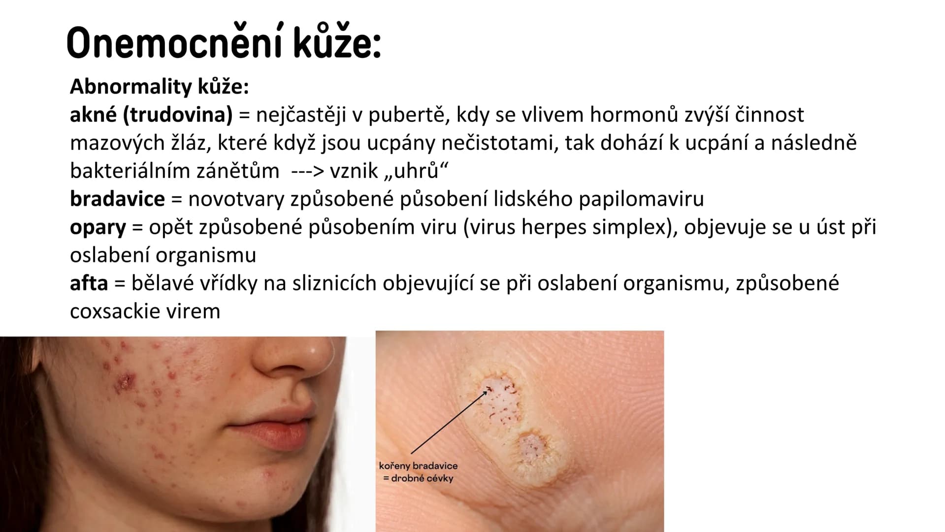 # Vylučovací soustava

- ledvina
- močovod
- močový měchýř
- močová trubice

řez ledvinou # Vylučovací soustava:

• funkce: - odstraňování o