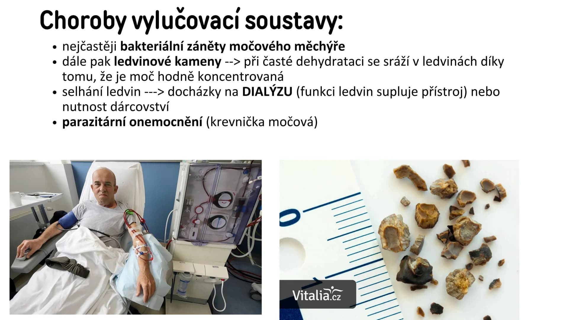 # Vylučovací soustava

- ledvina
- močovod
- močový měchýř
- močová trubice

řez ledvinou # Vylučovací soustava:

• funkce: - odstraňování o